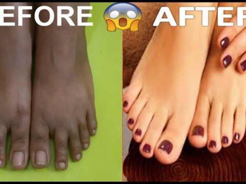 feet whitening pedicure