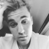 justin bieber is overcome with anxiety