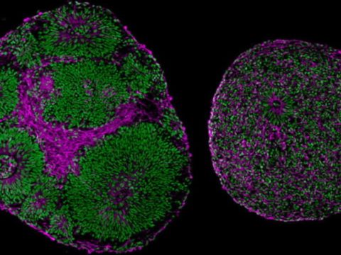 Brain organoids Autism linked gene 1651660491989